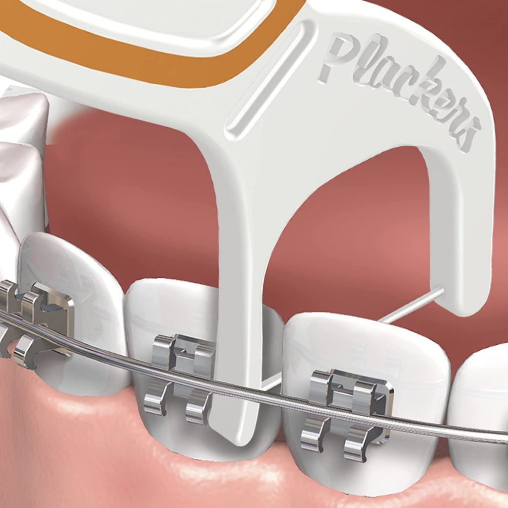 La partie amincie du bras glisse facilement entre les dents et la fil de métal pour enlever la plaque et les particules de nourriture.  Peut être utilisé pour les dents arrières.